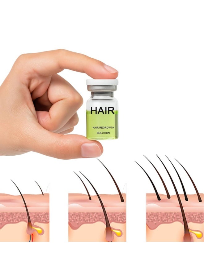 وينز تاون مجموعة محلول تكثيف الشعر بالإبر الدقيقة 30 مل | شعر أكثر كثافة، يقوي الجذور، لطيف وغير مؤلم، يدعم نمو الشعر الصحي للرجال والنساء (6 زجاجات من السيروم + 2 بكرات إبر دقيقة) - Image 3